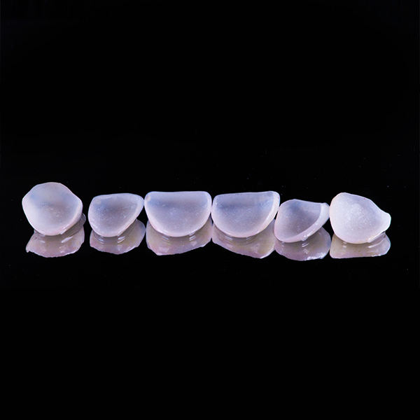 porcelain veneers near me