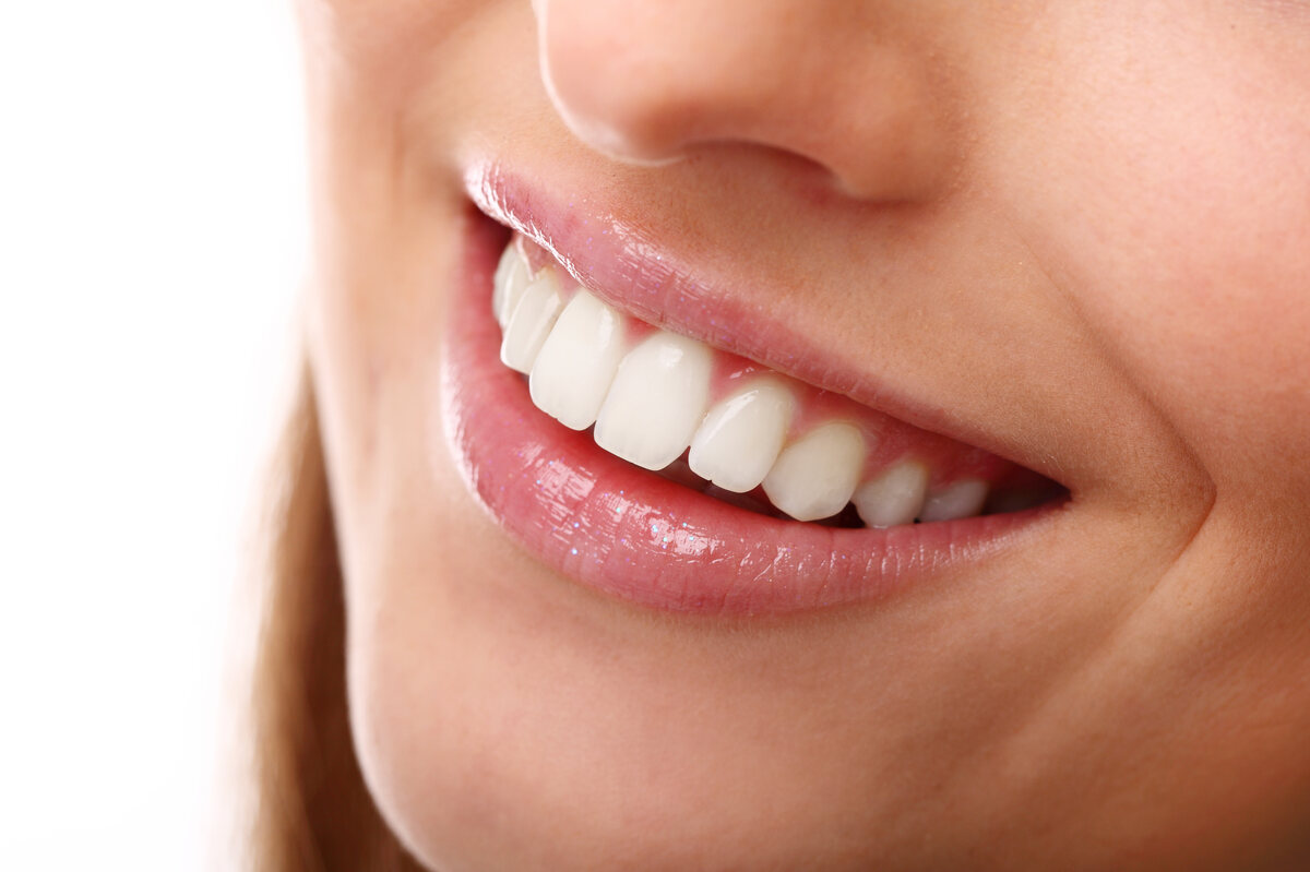 veneers explained how they bring new life to your teeth and confidence