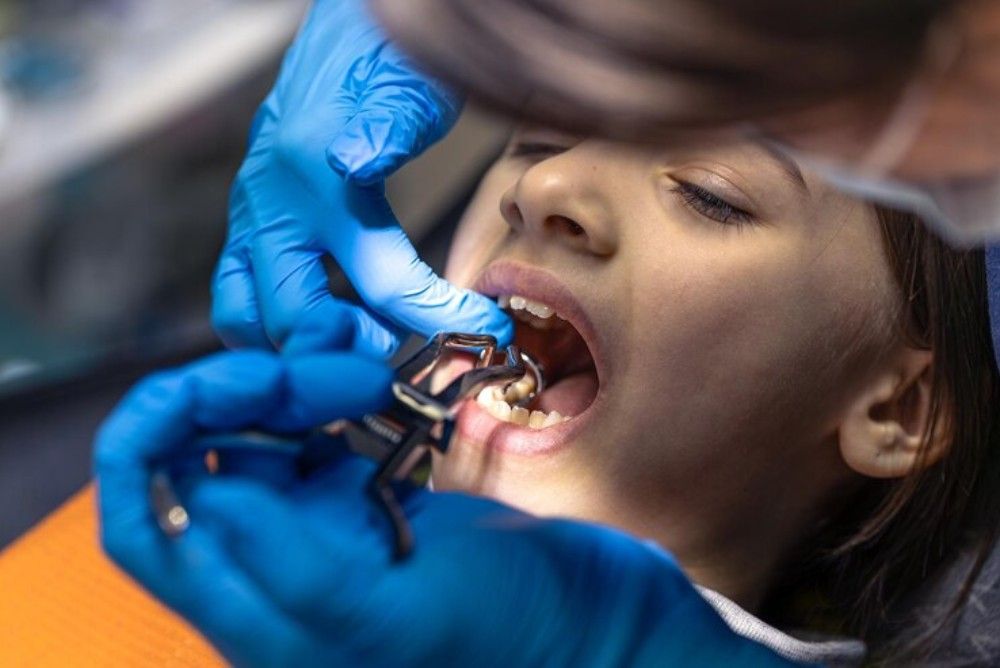 Your 4-Step Guide to Tooth Extractions