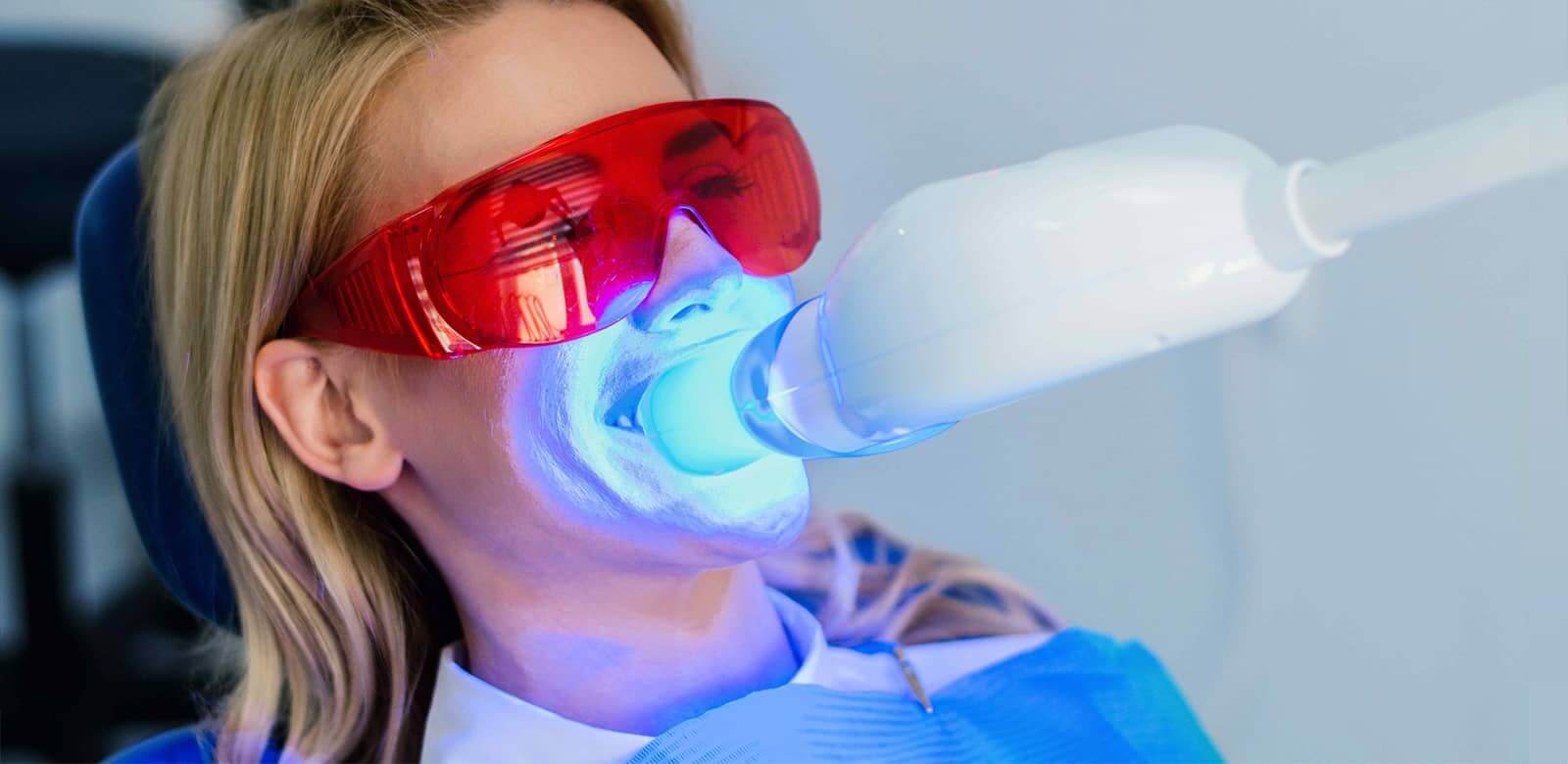 zoom teeth whitening vancouver