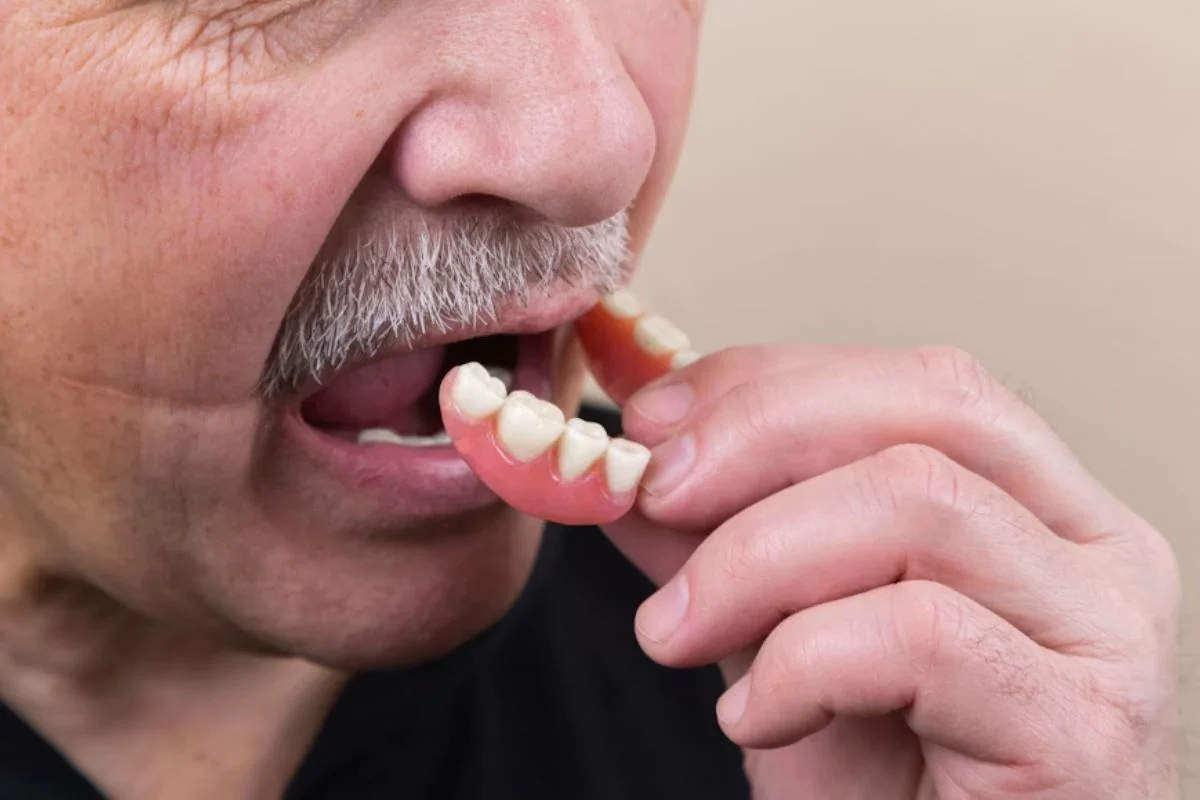 Man Wearing Natural-Looking Dentures For Restoring Missing Teeth And Smile Function